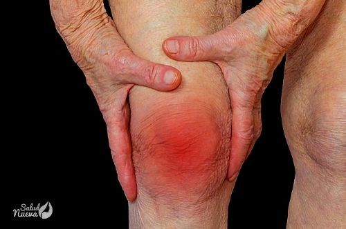 8 mejores remedios naturales para la osteoartritis
