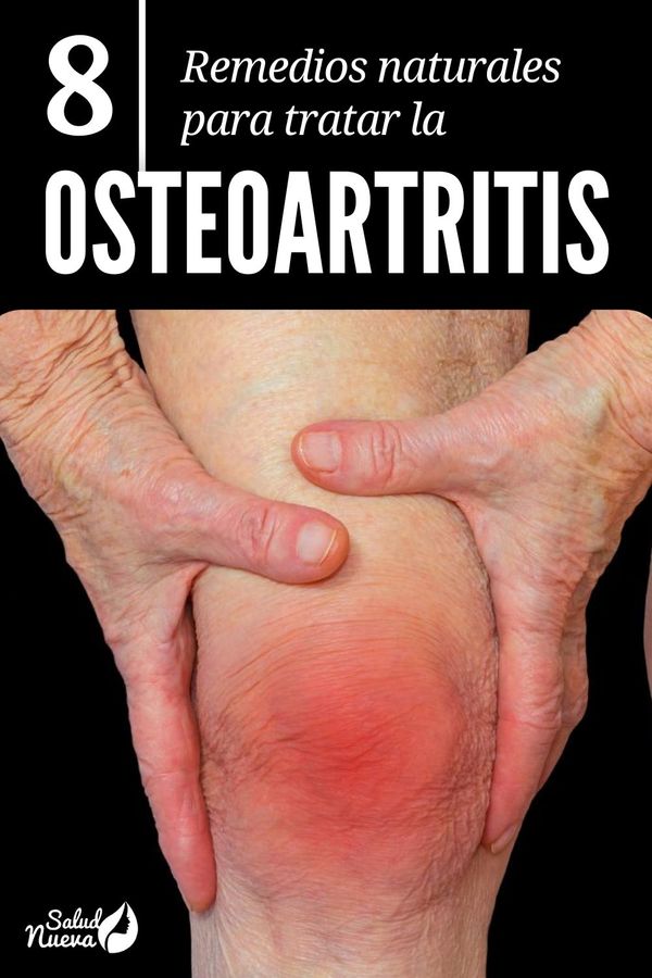Los 8 mejores remedios naturales para la osteoartritis