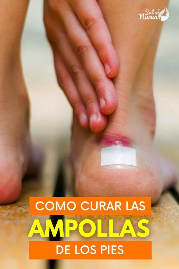 como curar las ampollas de los pies